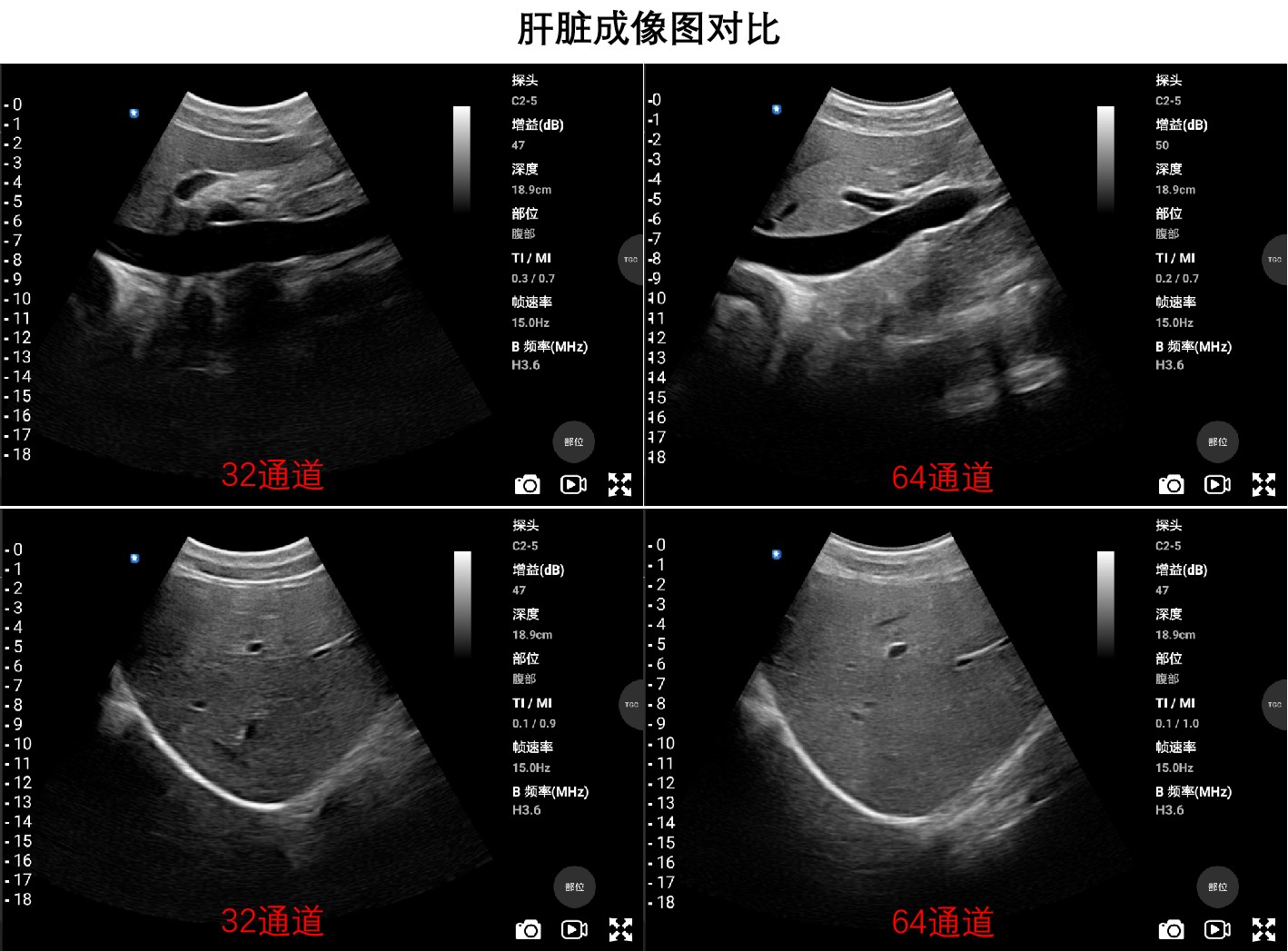 对比1.jpg