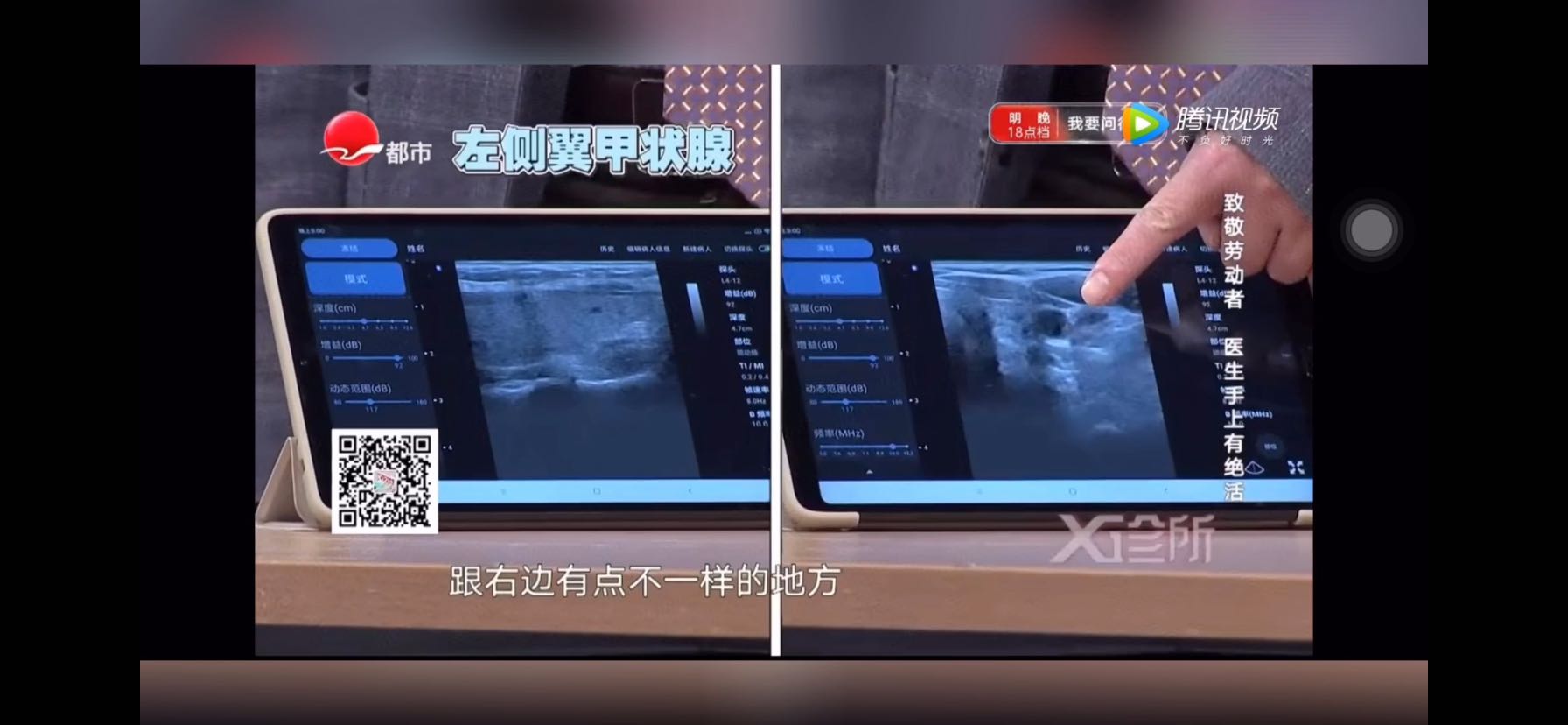对比.jpg