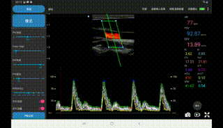 4.gif