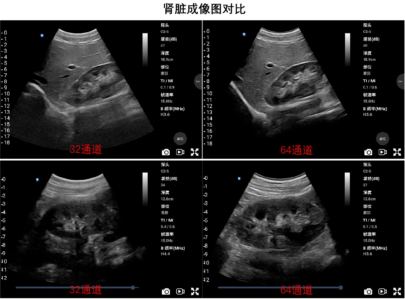 对比2.jpg
